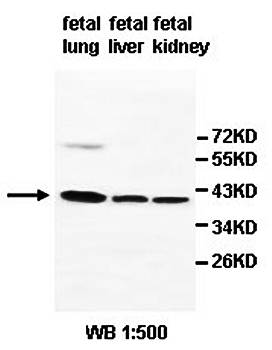 SERPINB6 Rabbit Polyclonal Antibody