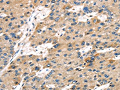 SERPINB8 Antibody