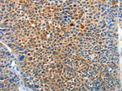 SERPINF2 Antibody