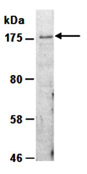SETDB1 (N) Antibody, Rabbit Polyclonal