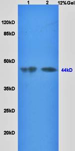 SHBG Rabbit Polyclonal Antibody