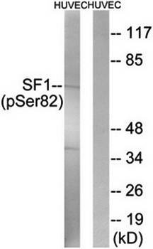 SF1 (Phospho-Ser82) Antibody