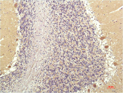 SGK1 Antibody