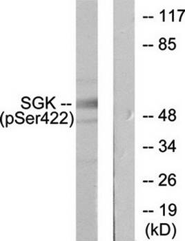 SGK (Phospho-Ser422) Antibody