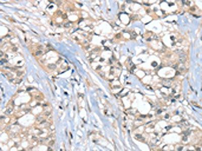 SGPL1 Antibody