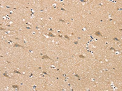SGPL1 Antibody
