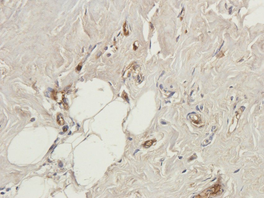 SGPP1 Rabbit Polyclonal Antibody