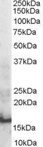 SH2D1A/SAP Antibody