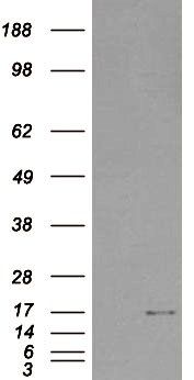 SH2D1A/SAP Antibody