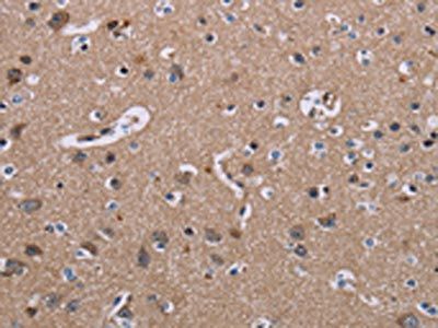 SH2D3A Antibody