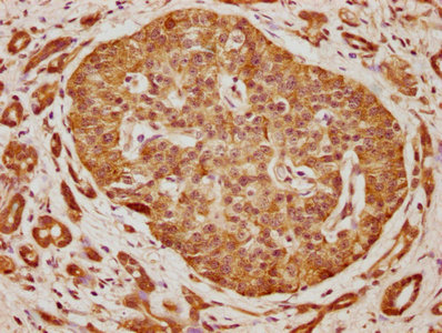 SH2D3A Antibody