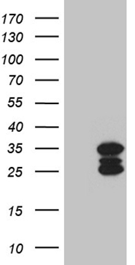 SH3BGR Antibody