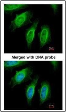 SH3GL1 Rabbit Polyclonal Antibody