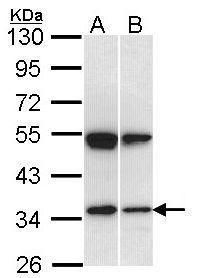 SH3GL1 Rabbit Polyclonal Antibody