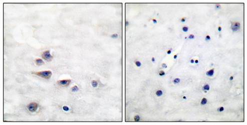 Shc (Phospho-Tyr427) Antibody