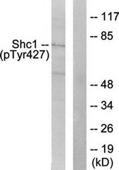 Shc (Phospho-Tyr427) Antibody