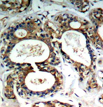 SHP-2 (Phospho-Tyr542) Antibody