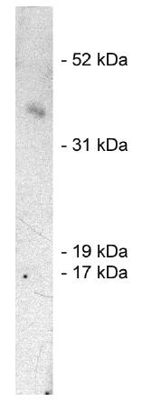 Rabbit anti Human SIAH1, E3 Ubiquitin Ligase Antibody