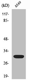SIAH1/SIAH2 Antibody