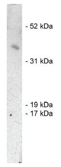 Rabbit anti Human SIAH1, E3 Ubiquitin Ligase Antibody