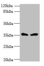 SIGLEC15 Antibody