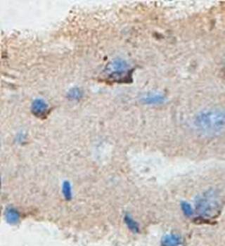 Sin1 Rabbit Polyclonal Antibody