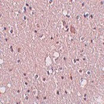 SIPA1L2 Antibody