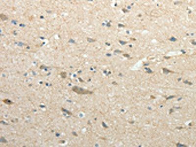 SIRT3 Antibody