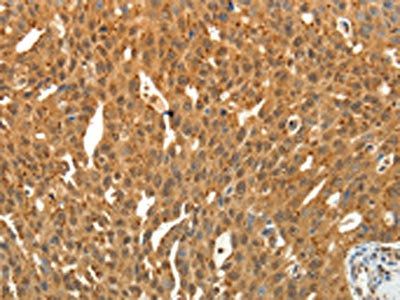 SIRT4 Antibody