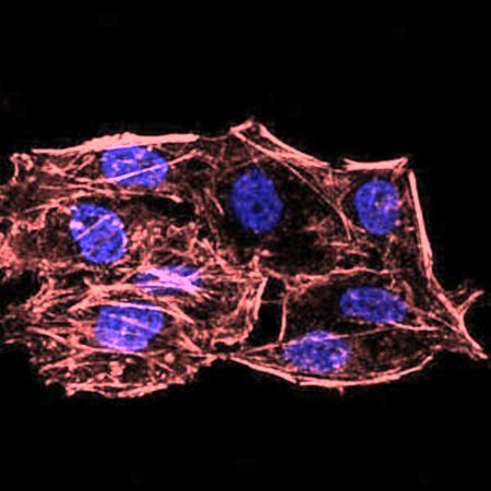 SIRT6 Antibody