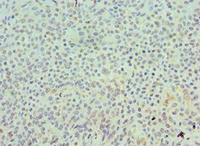 SKP1 Antibody