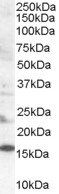 SH2D1A/SLAM associated protein Antibody