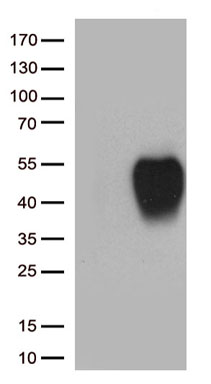 SLAMF7 Antibody