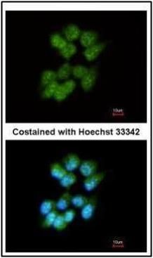 Src like adaptor Antibody