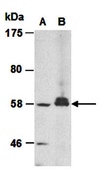 SLC11A1 (N) Antibody, Rabbit Polyclonal