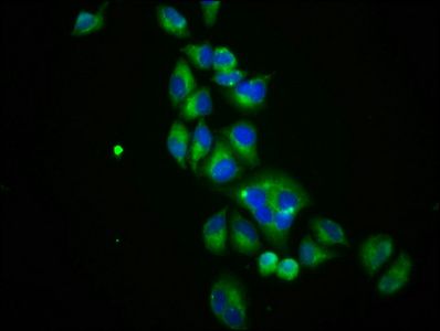 SLC12A3 Antibody