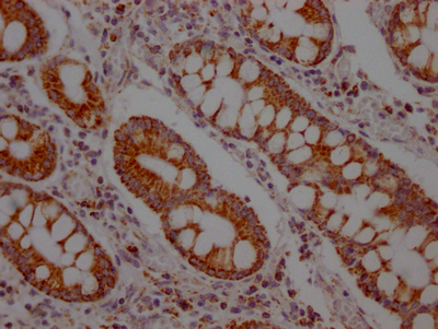 SLC16A1 Antibody