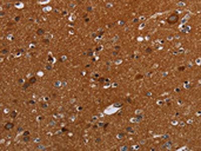 SLC22A12 Antibody