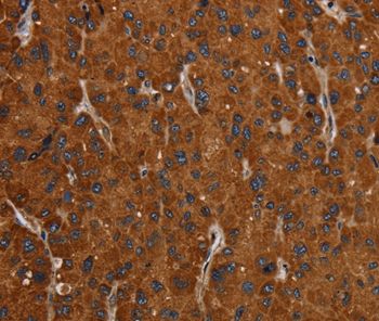 SLC22A12 Rabbit Polyclonal Antibody