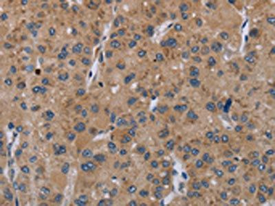 SLC22A2 Antibody