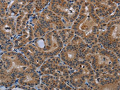 SLC22A2 Antibody