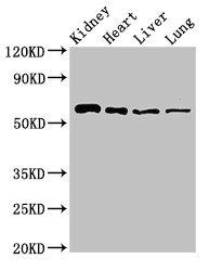 SLC22A2 Antibody