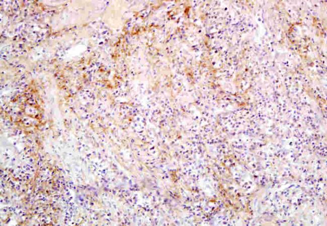 SLC27A2 Rabbit Polyclonal Antibody