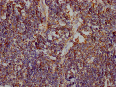 SLC2A1 Antibody