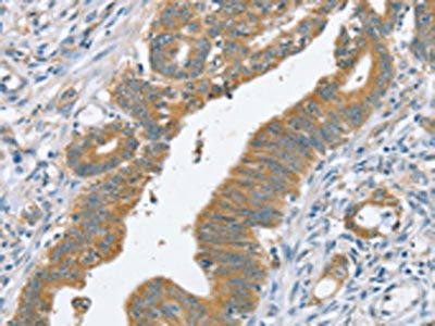 SLC39A3 Antibody