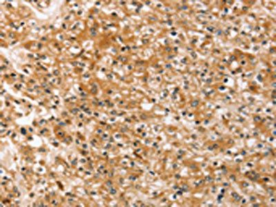 SLC40A1 Antibody