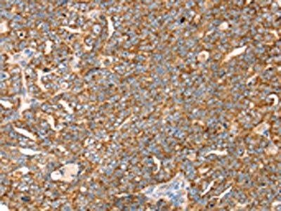 SLC8A3 Antibody