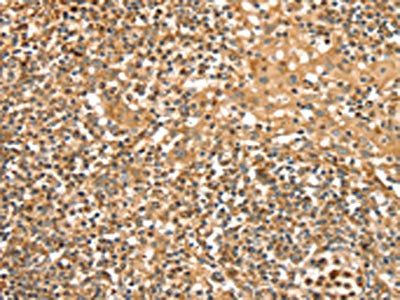 SLC8A3 Antibody