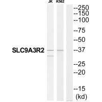 SLC9A3R2 Antibody