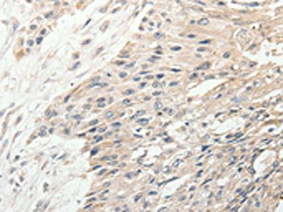 SLC9A7 Antibody